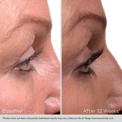 Obagi NU-CIL Eyelash