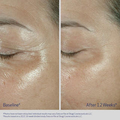 ELASTIderm Firming Eye Cream