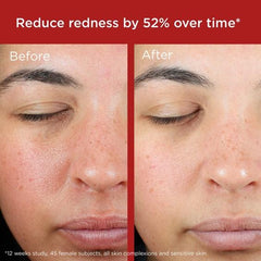 EltaMD UV Skin Recovery Red Color Correcting Green Tint Broad Spectrum SPF 50