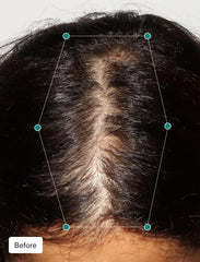 Woman Hair Grown